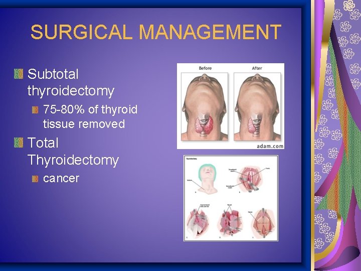 SURGICAL MANAGEMENT Subtotal thyroidectomy 75 -80% of thyroid tissue removed Total Thyroidectomy cancer 