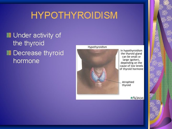 HYPOTHYROIDISM Under activity of the thyroid Decrease thyroid hormone 