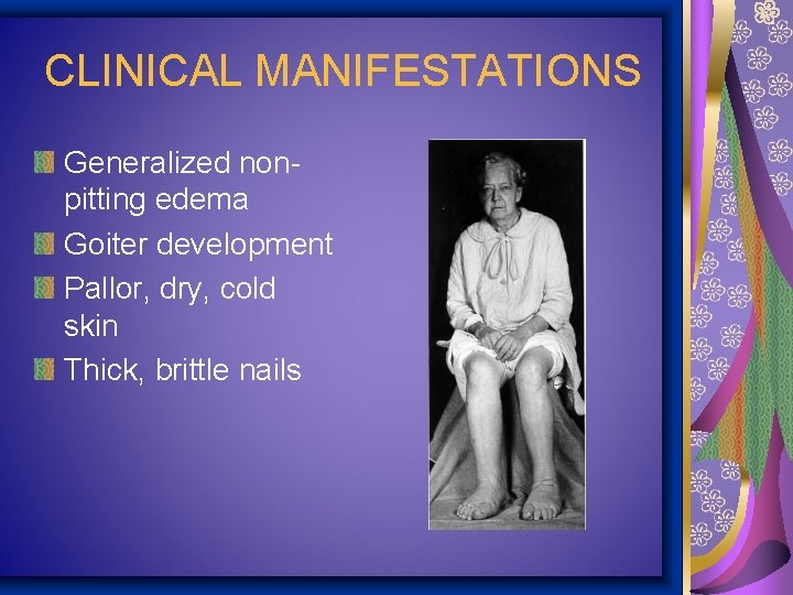 CLINICAL MANIFESTATIONS Generalized nonpitting edema Goiter development Pallor, dry, cold skin Thick, brittle nails