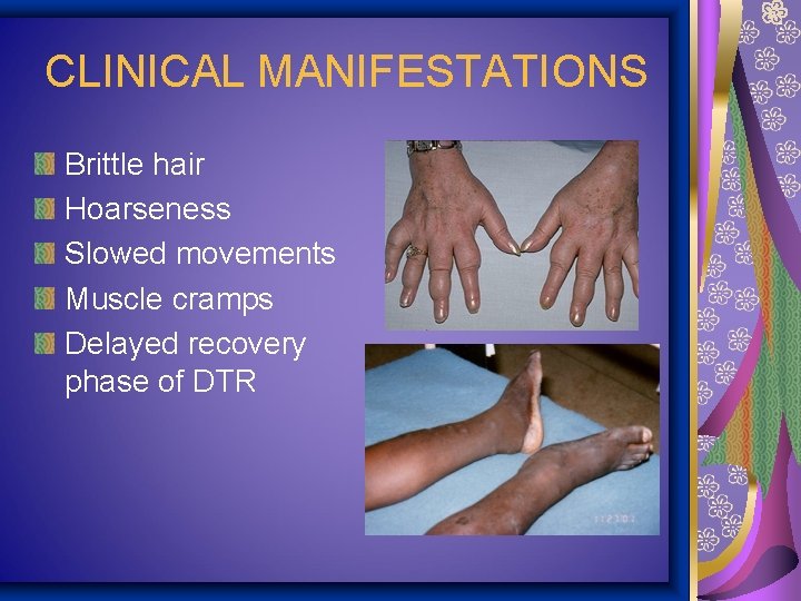 CLINICAL MANIFESTATIONS Brittle hair Hoarseness Slowed movements Muscle cramps Delayed recovery phase of DTR