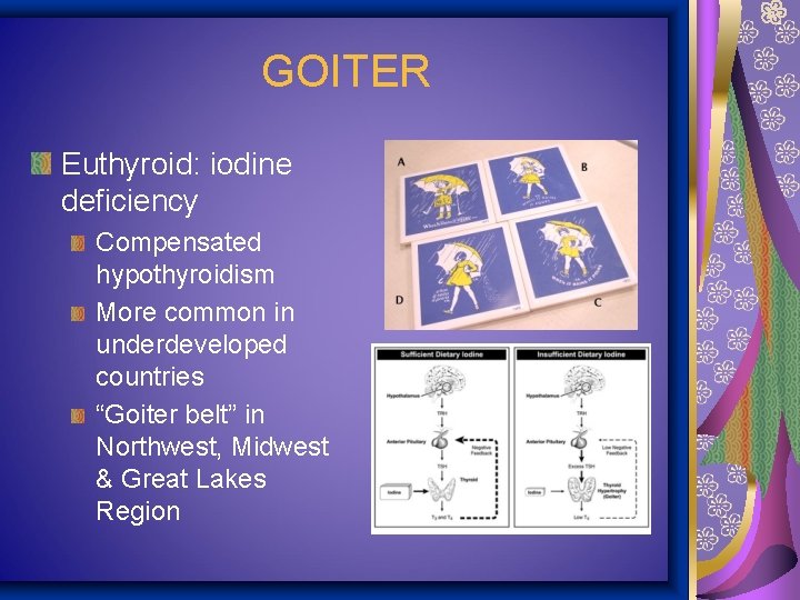 GOITER Euthyroid: iodine deficiency Compensated hypothyroidism More common in underdeveloped countries “Goiter belt” in