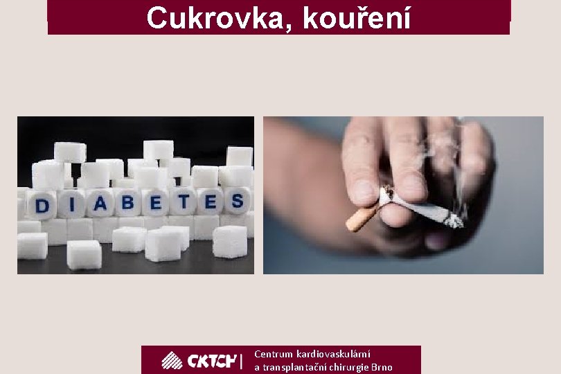 Cukrovka, kouření Centrum kardiovaskulární a transplantační chirurgie Brno 