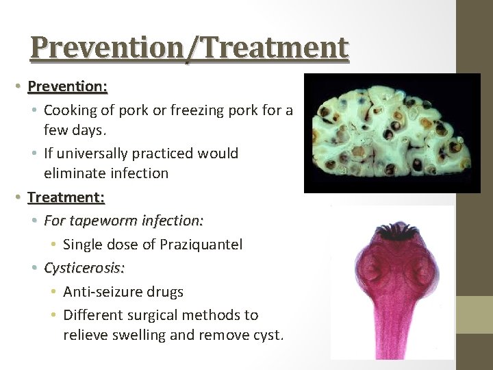 Prevention/Treatment • Prevention: • Cooking of pork or freezing pork for a few days.