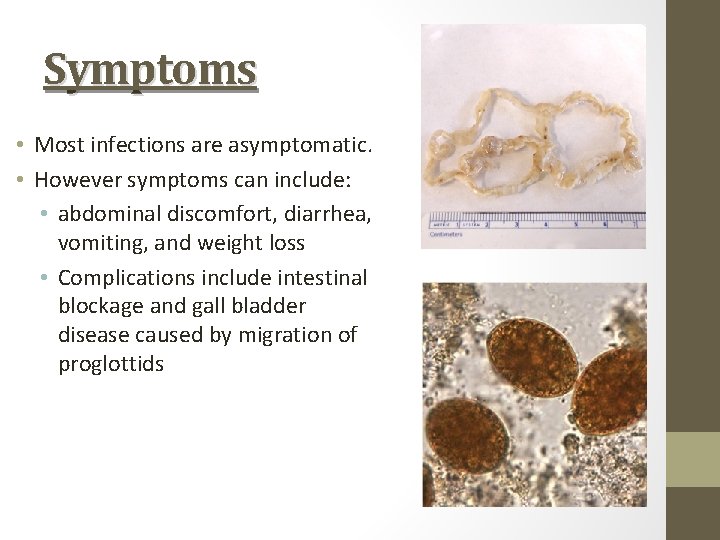 Symptoms • Most infections are asymptomatic. • However symptoms can include: • abdominal discomfort,