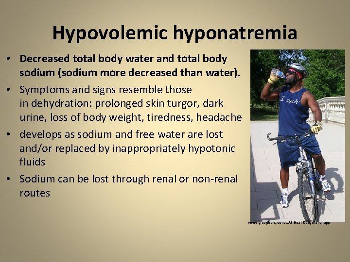 Hypovolemic hyponatremia • Decreased total body water and total body sodium (sodium more decreased