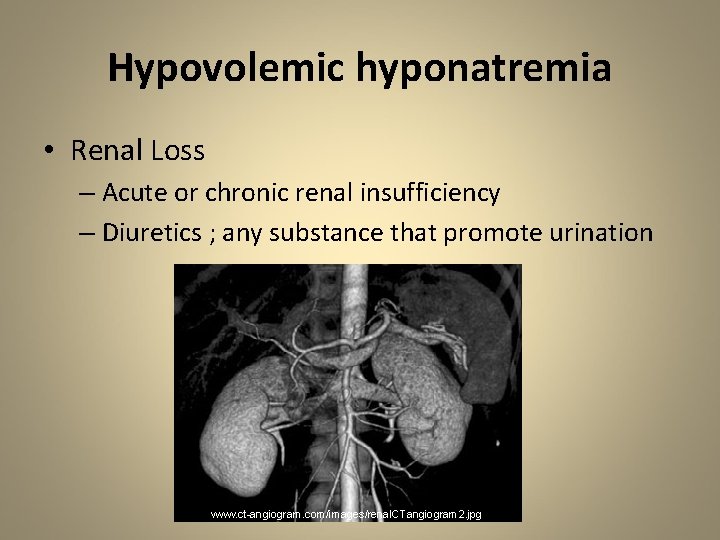 Hypovolemic hyponatremia • Renal Loss – Acute or chronic renal insufficiency – Diuretics ;