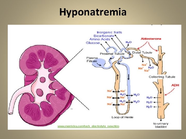 Hyponatremia www. merricks. com/tech_electrolyte_new. htm 