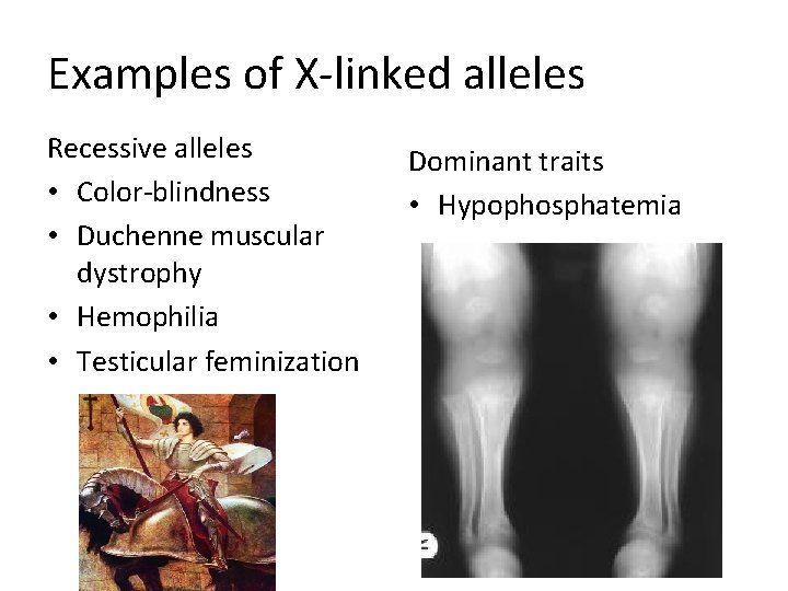 Examples of X-linked alleles Recessive alleles • Color-blindness • Duchenne muscular dystrophy • Hemophilia
