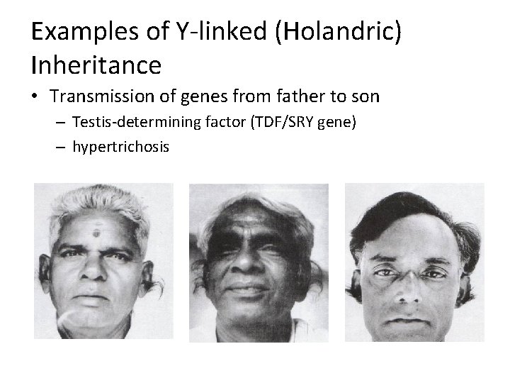 Examples of Y-linked (Holandric) Inheritance • Transmission of genes from father to son –