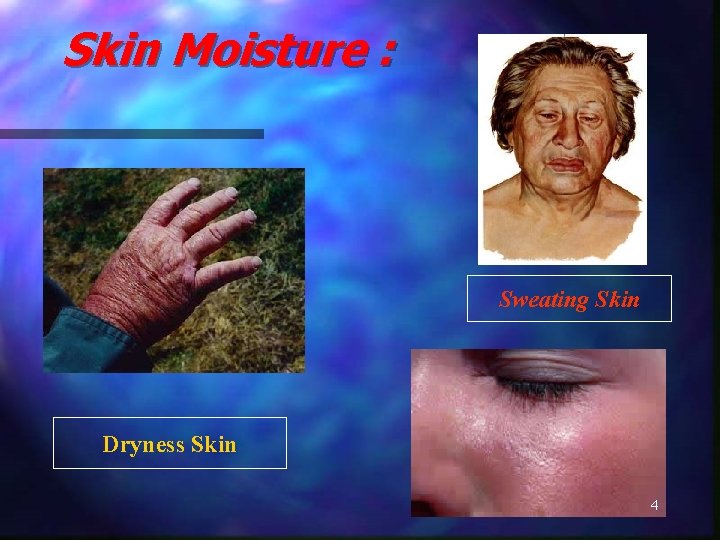 Skin Moisture : Sweating Skin Dryness Skin 4 