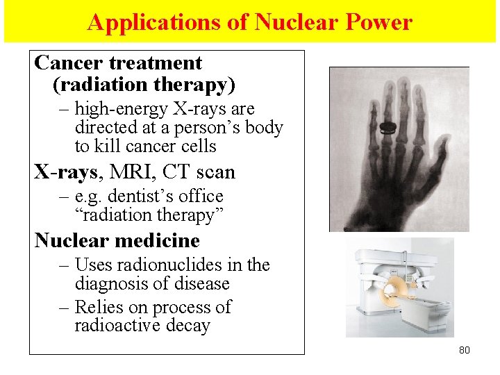 Applications of Nuclear Power Cancer treatment (radiation therapy) – high-energy X-rays are directed at