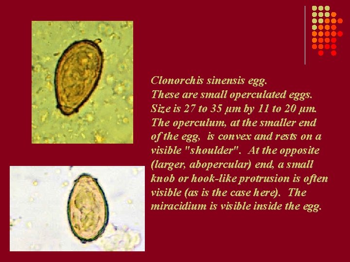 Clonorchis sinensis egg. These are small operculated eggs. Size is 27 to 35 µm Clonorchis sinensis egg. These are small operculated eggs. Size is 27 to 35 µm