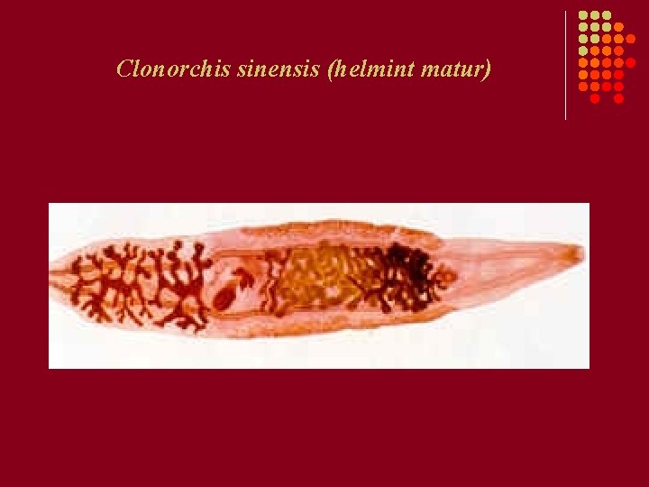 Clonorchis sinensis (helmint matur) Clonorchis sinensis (helmint matur)