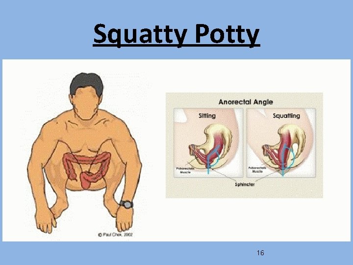 Squatty Potty 16 