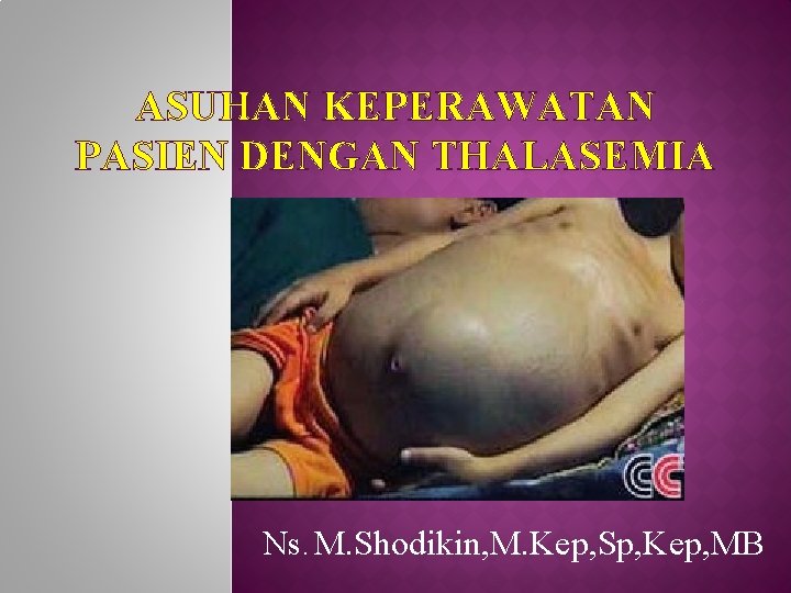 ASUHAN KEPERAWATAN PASIEN DENGAN THALASEMIA Ns. M. Shodikin, M. Kep, Sp, Kep, MB 