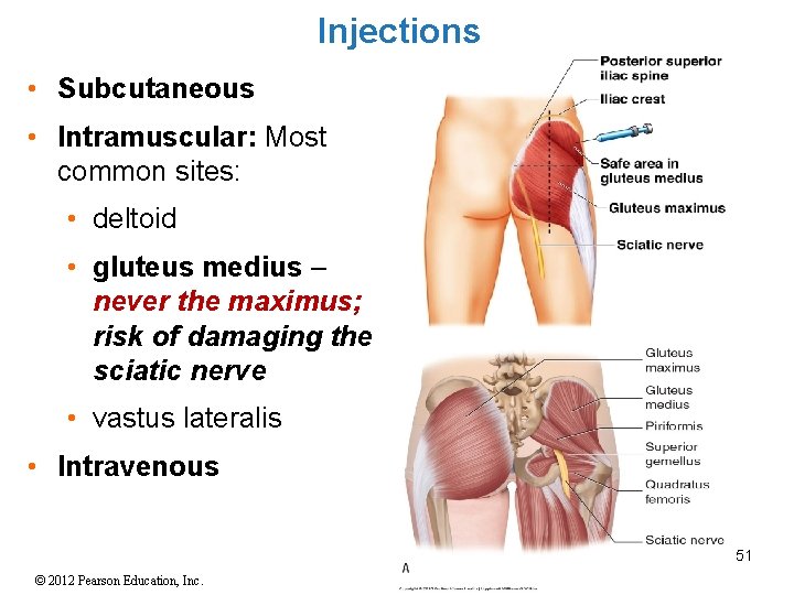 Injections • Subcutaneous • Intramuscular: Most common sites: • deltoid • gluteus medius –