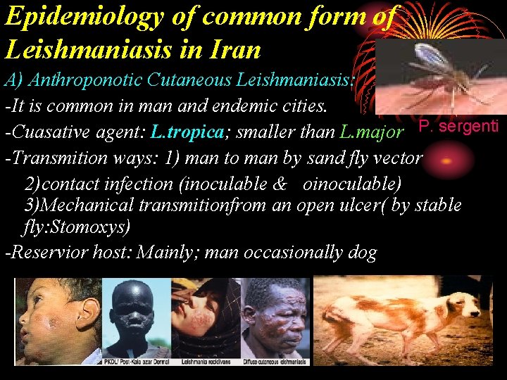 Epidemiology of common form of Leishmaniasis in Iran A) Anthroponotic Cutaneous Leishmaniasis: -It is