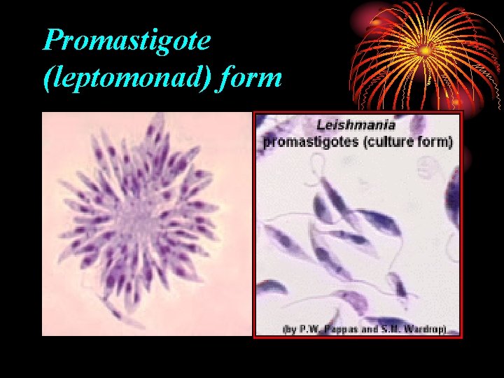 Promastigote (leptomonad) form 