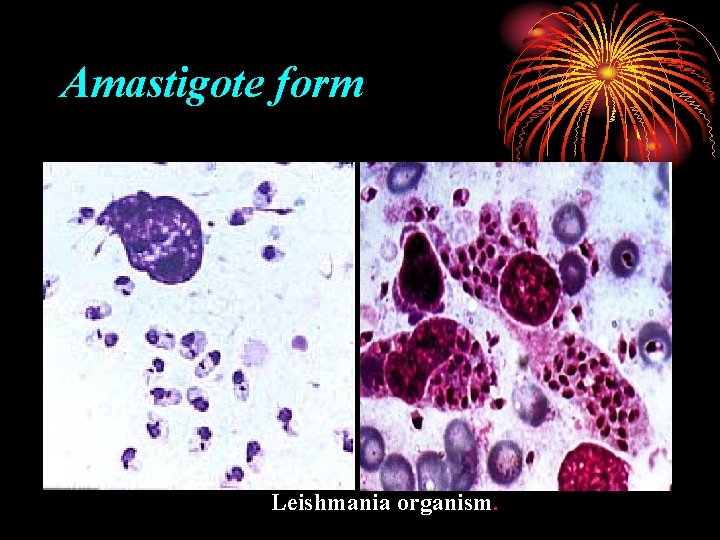 Amastigote form Leishmania organism. 