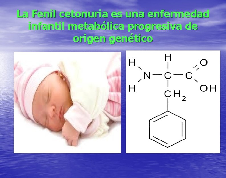 La Fenil cetonuria es una enfermedad infantil metabólica progresiva de origen genético 