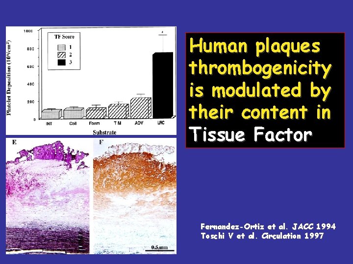 Human plaques thrombogenicity is modulated by their content in Tissue Factor Fernandez-Ortiz et al.