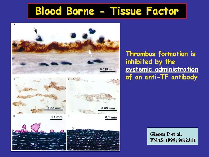 Blood Borne - Tissue Factor Thrombus formation is inhibited by the systemic administration of