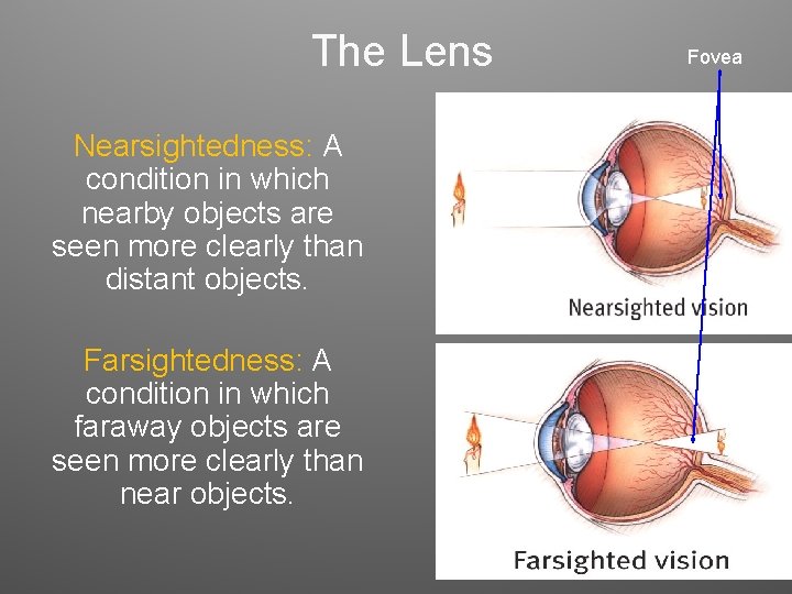 The Lens Nearsightedness: A condition in which nearby objects are seen more clearly than The Lens Nearsightedness: A condition in which nearby objects are seen more clearly than