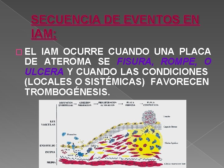 SECUENCIA DE EVENTOS EN IAM: � EL IAM OCURRE CUANDO UNA PLACA DE ATEROMA