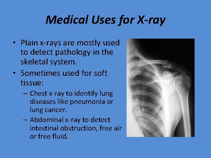 Medical Uses for X-ray • Plain x-rays are mostly used to detect pathology in