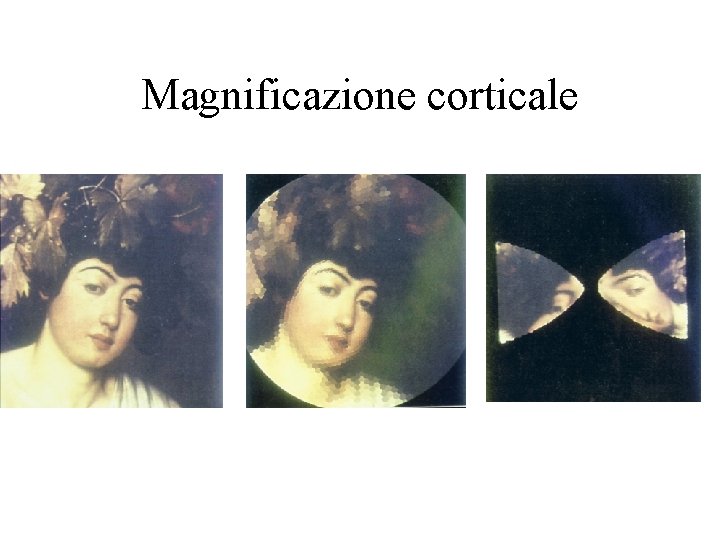 Magnificazione corticale 