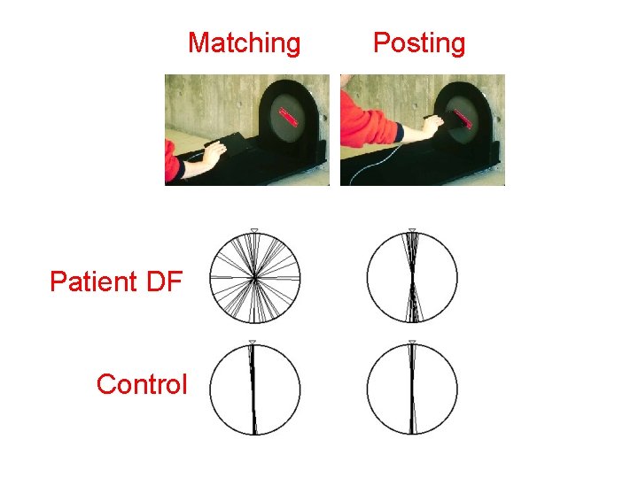 Matching Patient DF Control Posting 