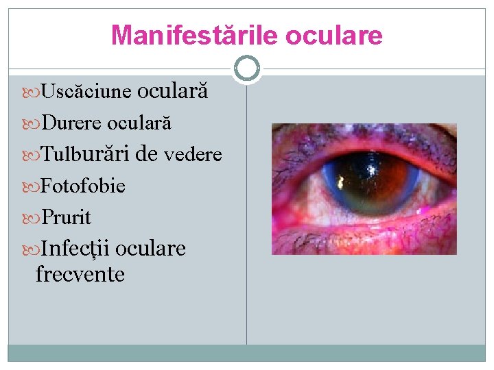 Manifestările oculare Uscăciune oculară Durere oculară Tulburări de vedere Fotofobie Prurit Infecții oculare frecvente