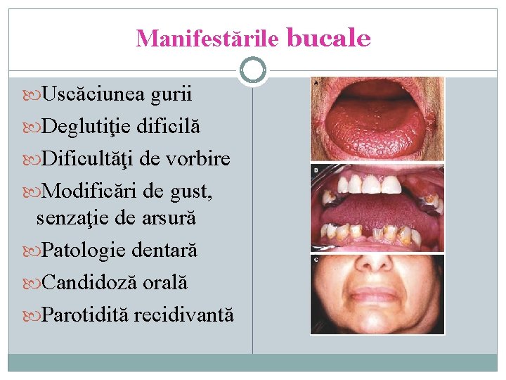 Manifestările bucale Uscăciunea gurii Deglutiţie dificilă Dificultăţi de vorbire Modificări de gust, senzaţie de