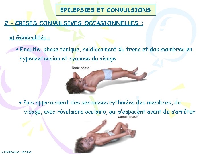 EPILEPSIES ET CONVULSIONS 2 – CRISES CONVULSIVES OCCASIONNELLES : a) Généralités : Ensuite, phase