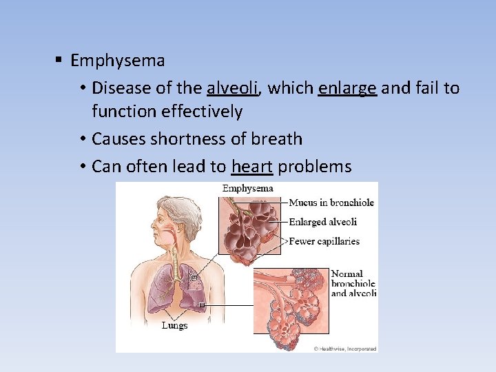 § Emphysema • Disease of the alveoli, which enlarge and fail to function effectively
