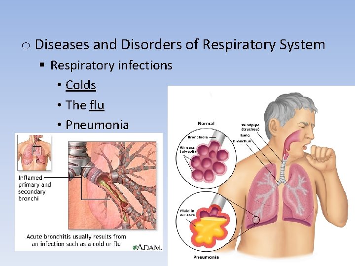o Diseases and Disorders of Respiratory System § Respiratory infections • Colds • The