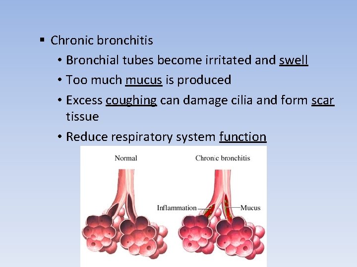 § Chronic bronchitis • Bronchial tubes become irritated and swell • Too much mucus
