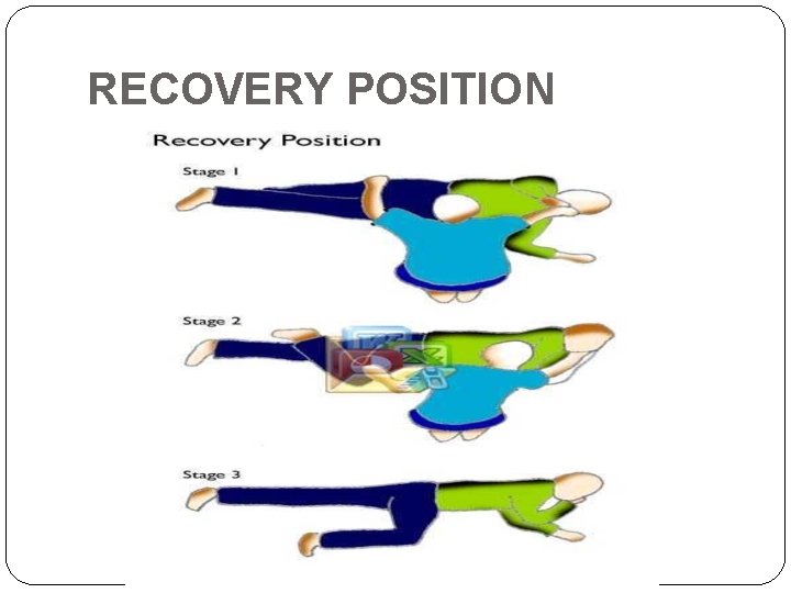 RECOVERY POSITION 