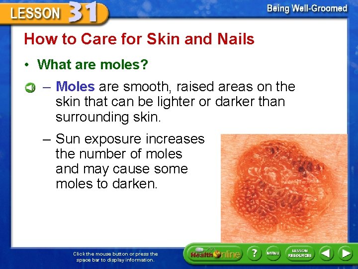 How to Care for Skin and Nails • What are moles? – Moles are