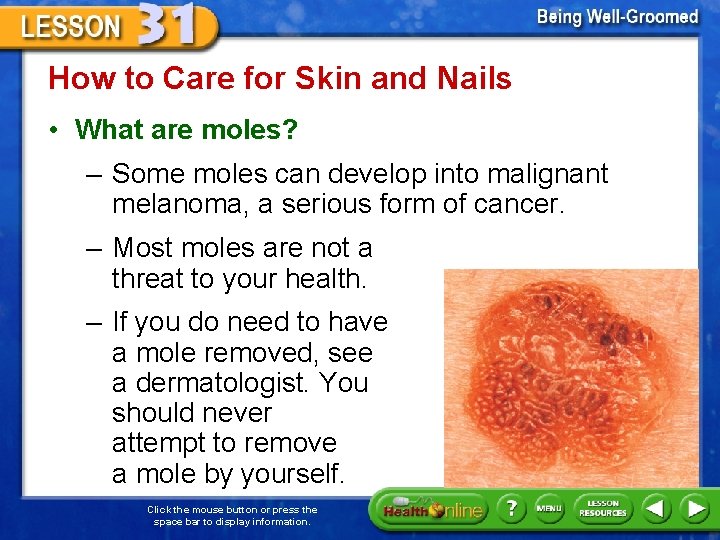 How to Care for Skin and Nails • What are moles? – Some moles