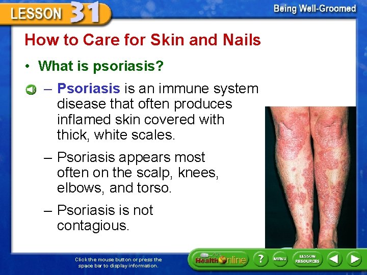 How to Care for Skin and Nails • What is psoriasis? – Psoriasis is