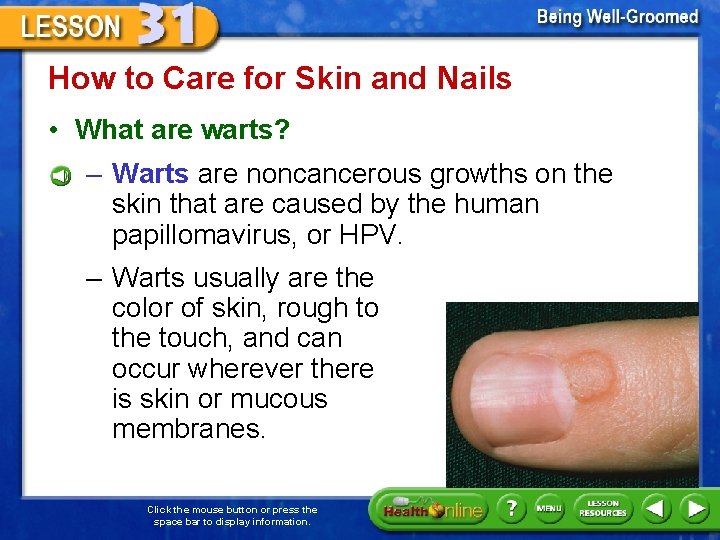 How to Care for Skin and Nails • What are warts? – Warts are