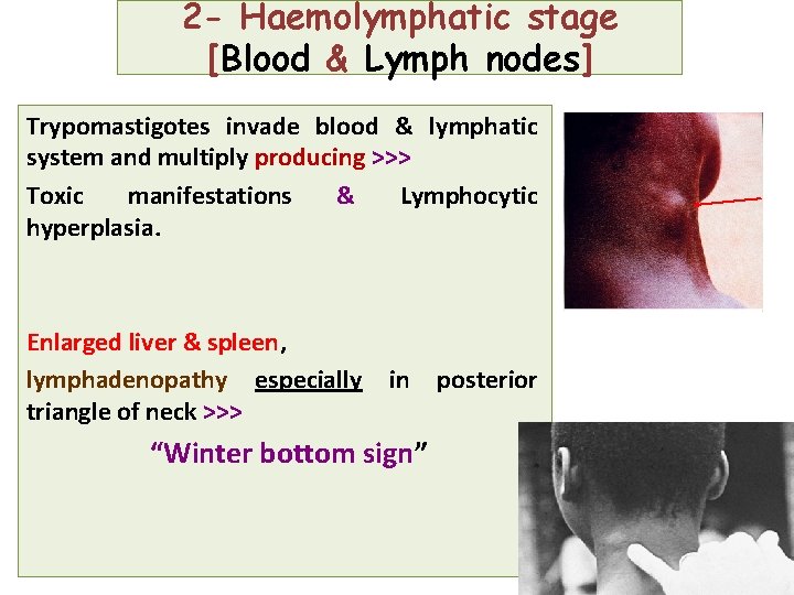 2 - Haemolymphatic stage [Blood & Lymph nodes] Trypomastigotes invade blood & lymphatic system