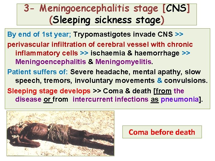 3 - Meningoencephalitis stage [CNS] (Sleeping sickness stage) By end of 1 st year;