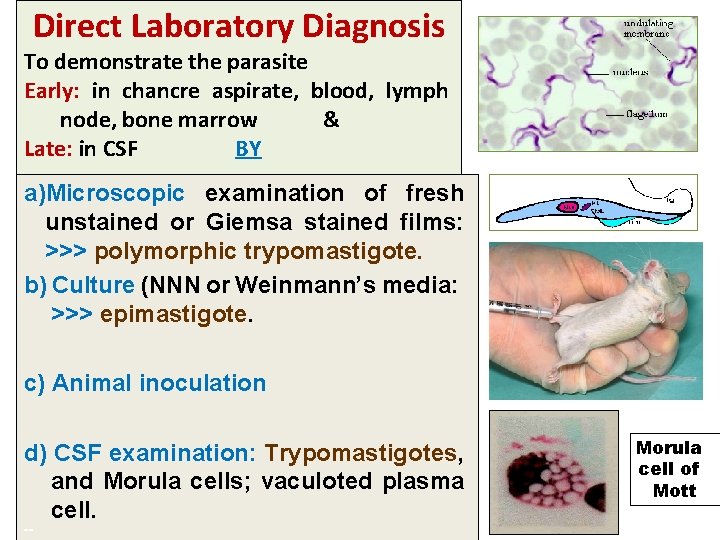 Direct Laboratory Diagnosis To demonstrate the parasite Early: in chancre aspirate, blood, lymph node,