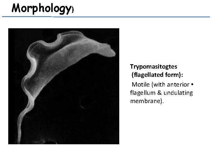 Morphology) Trypomasitogtes (flagellated form): Motile (with anterior • flagellum & undulating membrane). 