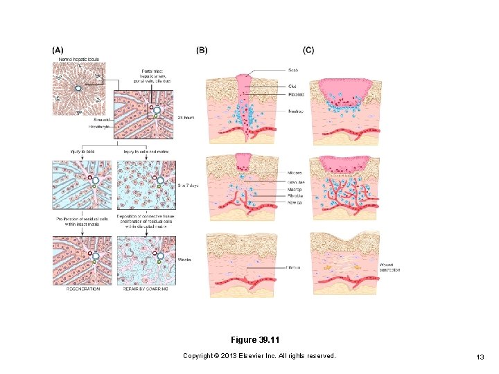 Figure 39. 11 Copyright © 2013 Elsevier Inc. All rights reserved. 13 