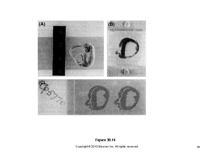 Figure 39. 14 Copyright © 2013 Elsevier Inc. All rights reserved. 16 