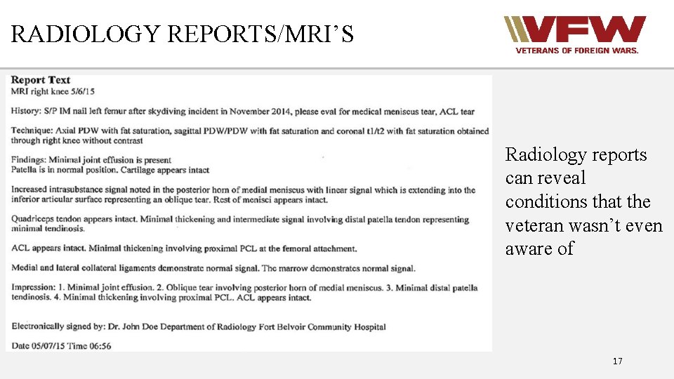 RADIOLOGY REPORTS/MRI’S Radiology reports can reveal conditions that the veteran wasn’t even aware of