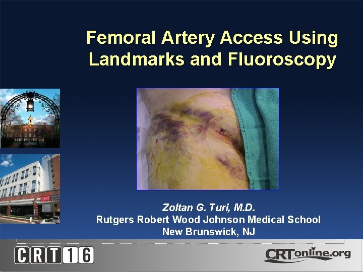 Femoral Artery Access Using Landmarks and Fluoroscopy Zoltan G. Turi, M. D. Rutgers Robert